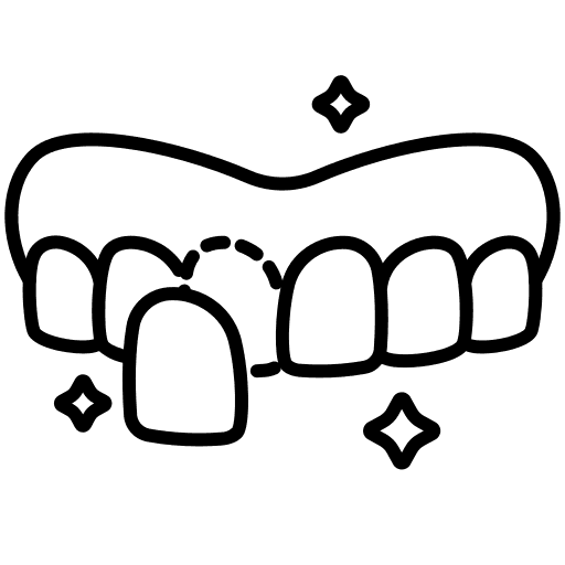 Porcelain veneers enhancing the appearance of a patient's smile